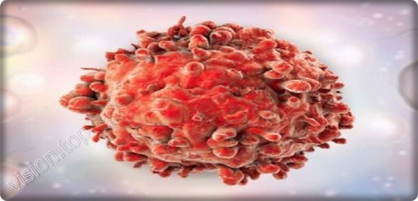 CAR-T، علاج جديد لسرطان الدم "اللوكيميا"