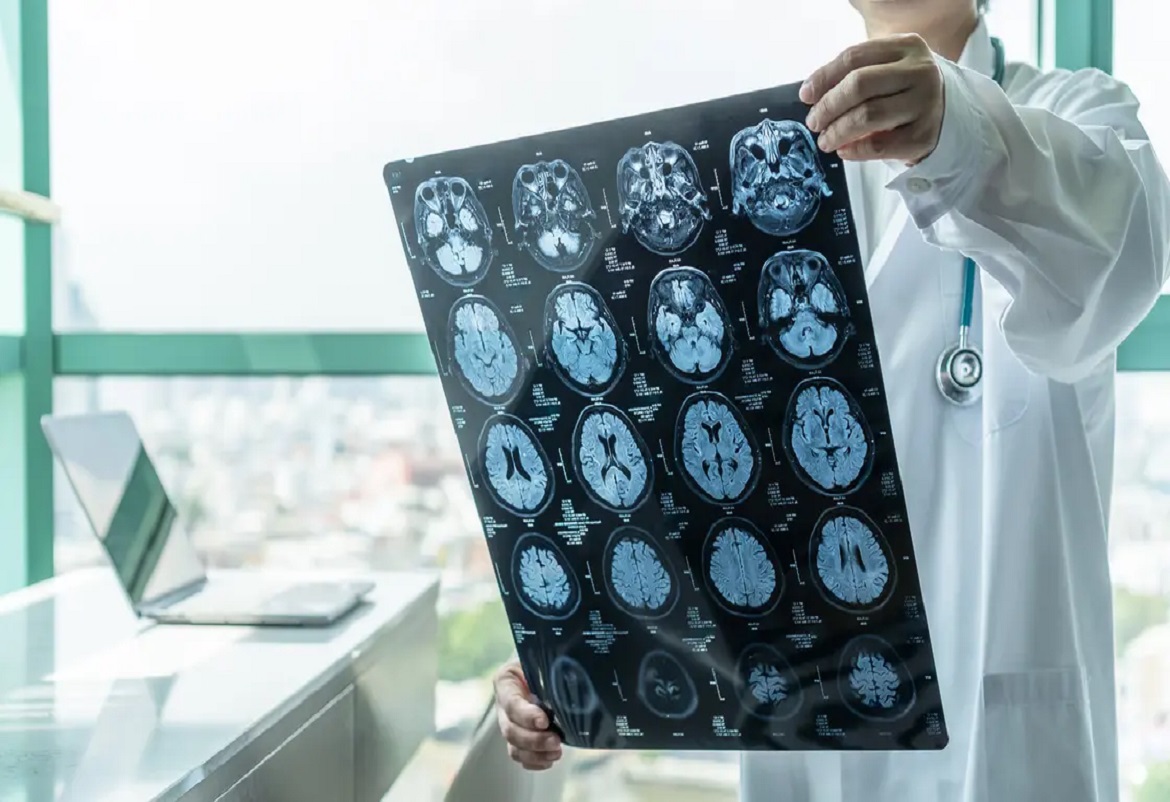 استكشفت دراسة أجرتها مؤسسة Royal Marsden NHS Foundation Trust ومعهد أبحاث السرطان استخدام الذكاء الاصطناعي في تصنيف عدوانية المرض.